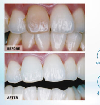 White Enhancement